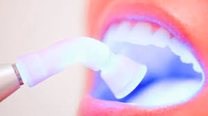 dentista na barra da tijuca clareamento dental