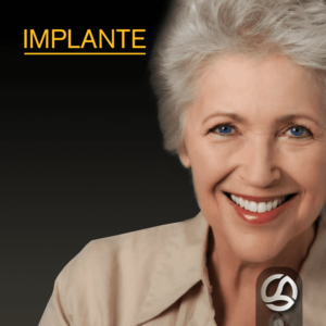 Implante: qual o tempo necessário para implantação após extração?